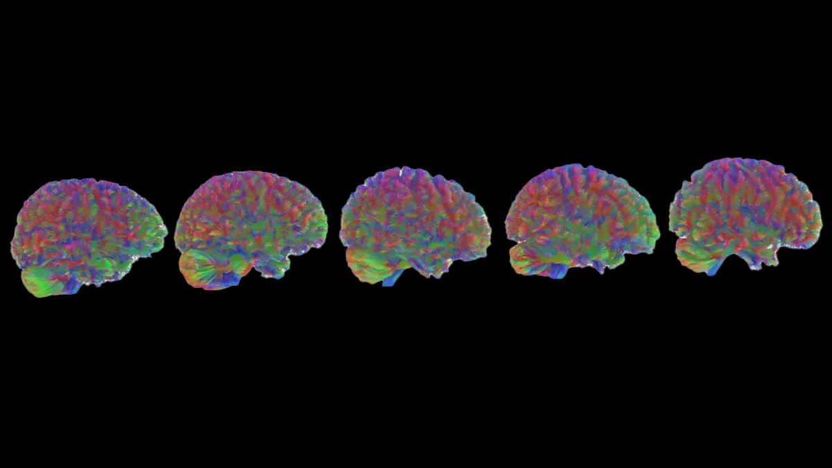 دانشمندان: مغز انسان پنج سن متفاوت دارد؛ ببینید شما در کدام مرحله هستید